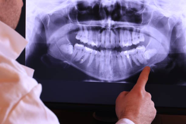 Best Broken Tooth Emergency  in Montclair, VA
