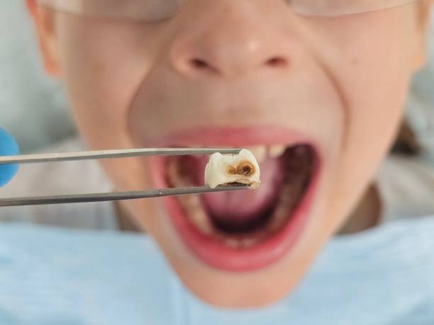 Emergency Dentist for Kids in VA