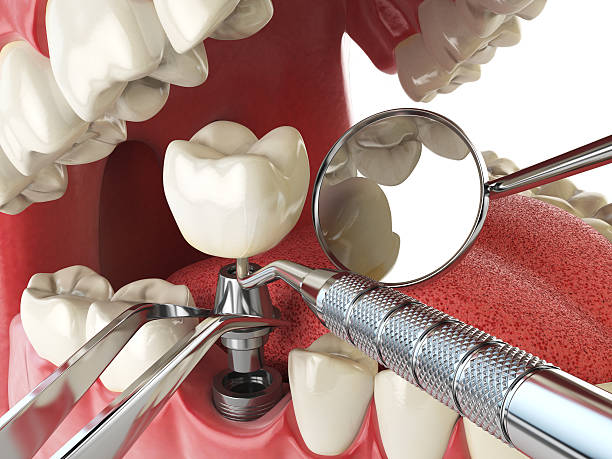 Best Root Canal Emergency Dentist  in Montclair, VA
