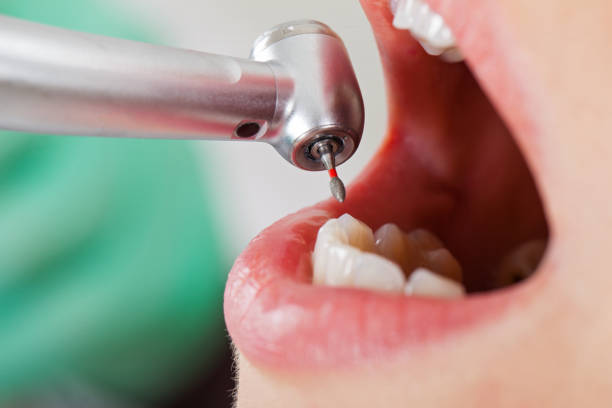  Montclair, VA Emergency Dentist Pros